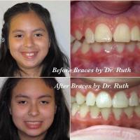 Braces by Dr Ruth Braces by Dr Ruth